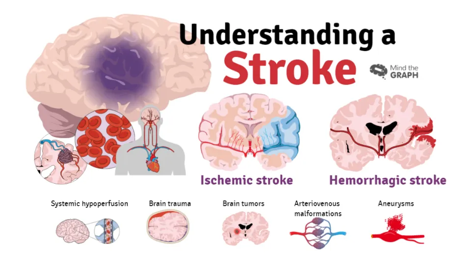 How Does AFib Cause Stroke? Definition and Treatments