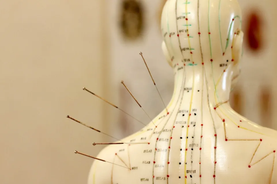 How Many Acupuncture Points Are There? (Solved)