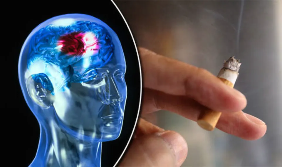 How Does Smoking Cause Stroke? 4 Risking Factors